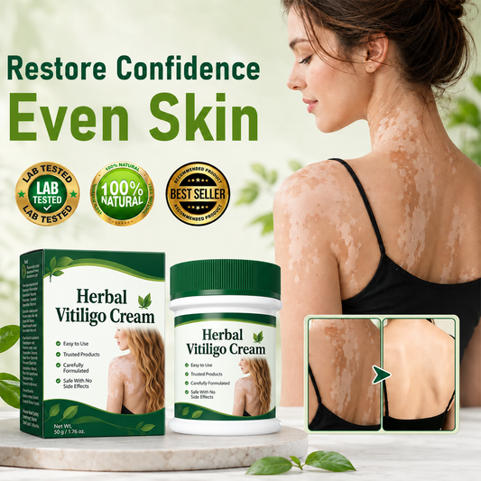 Herbal Vitiligo Cream